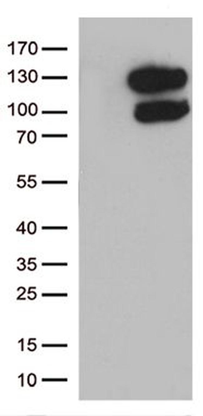 CCDC132 Antibody in Western Blot (WB)