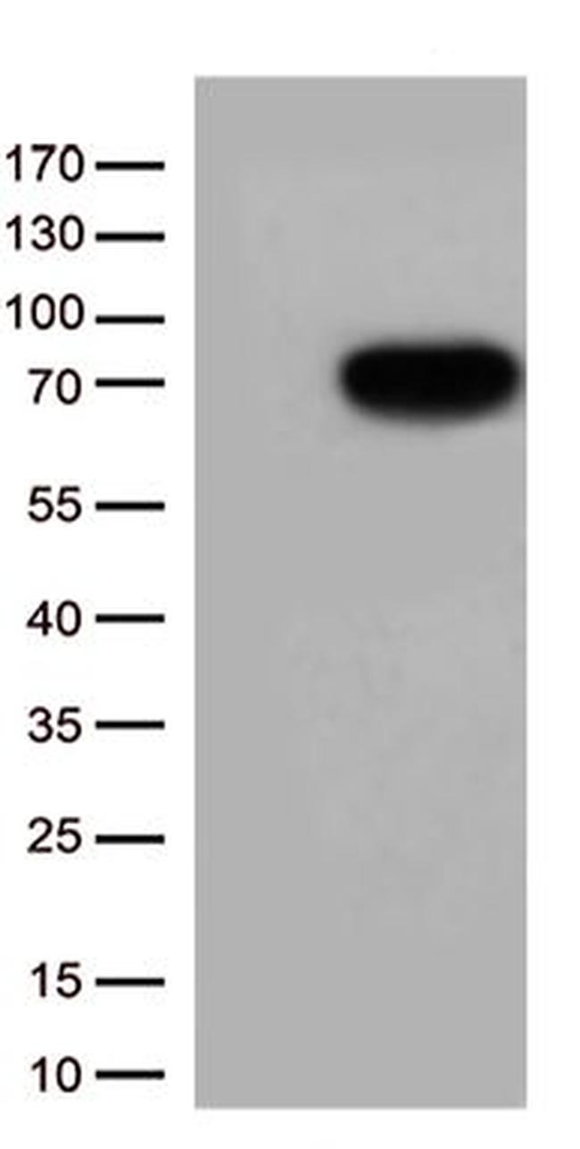 CSF2RA Antibody in Western Blot (WB)