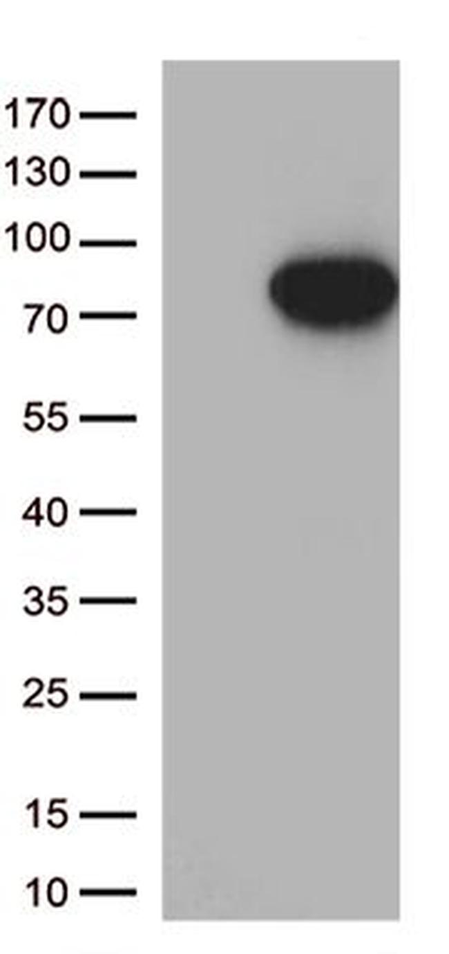 MASP2 Antibody in Western Blot (WB)