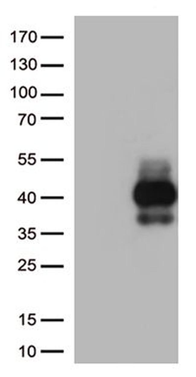 TIGIT Antibody in Western Blot (WB)