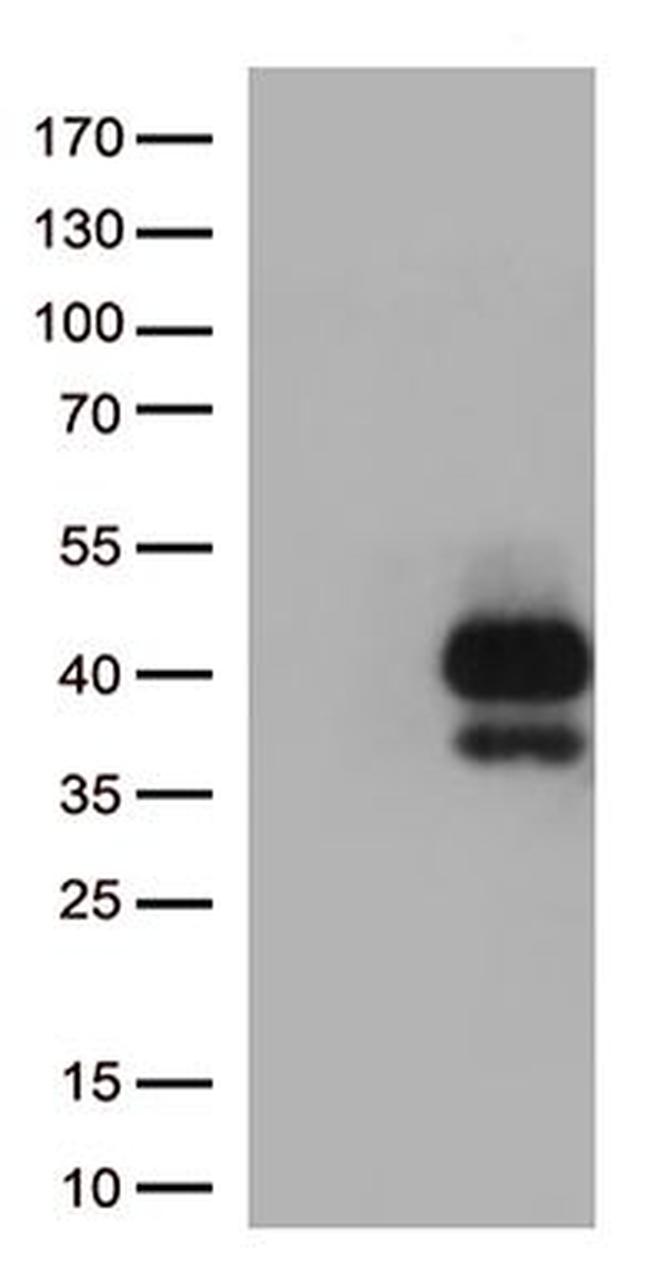 TIGIT Antibody in Western Blot (WB)