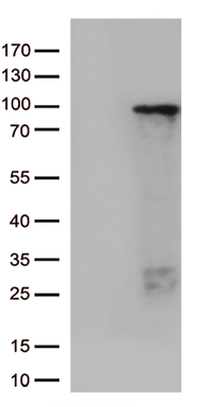 ZNF226 Antibody in Western Blot (WB)