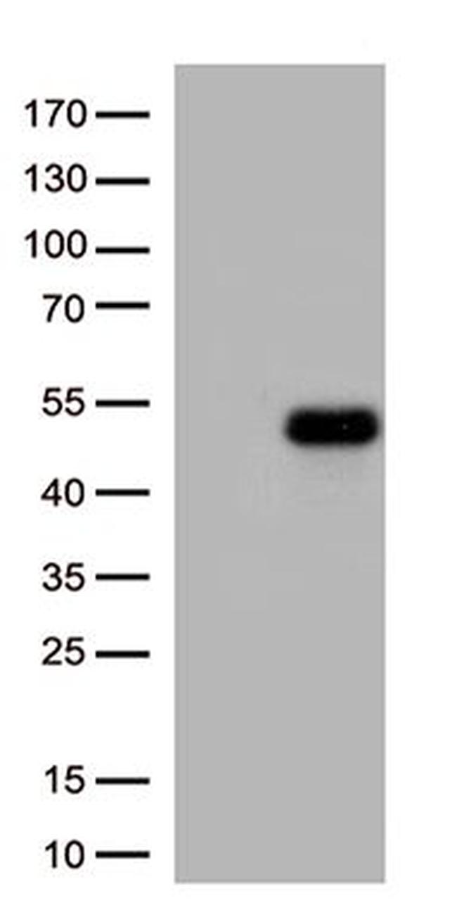 ATF4 Antibody in Western Blot (WB)