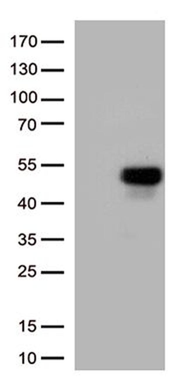 ATF4 Antibody in Western Blot (WB)
