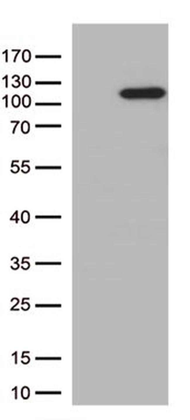 ERAP1 Antibody in Western Blot (WB)