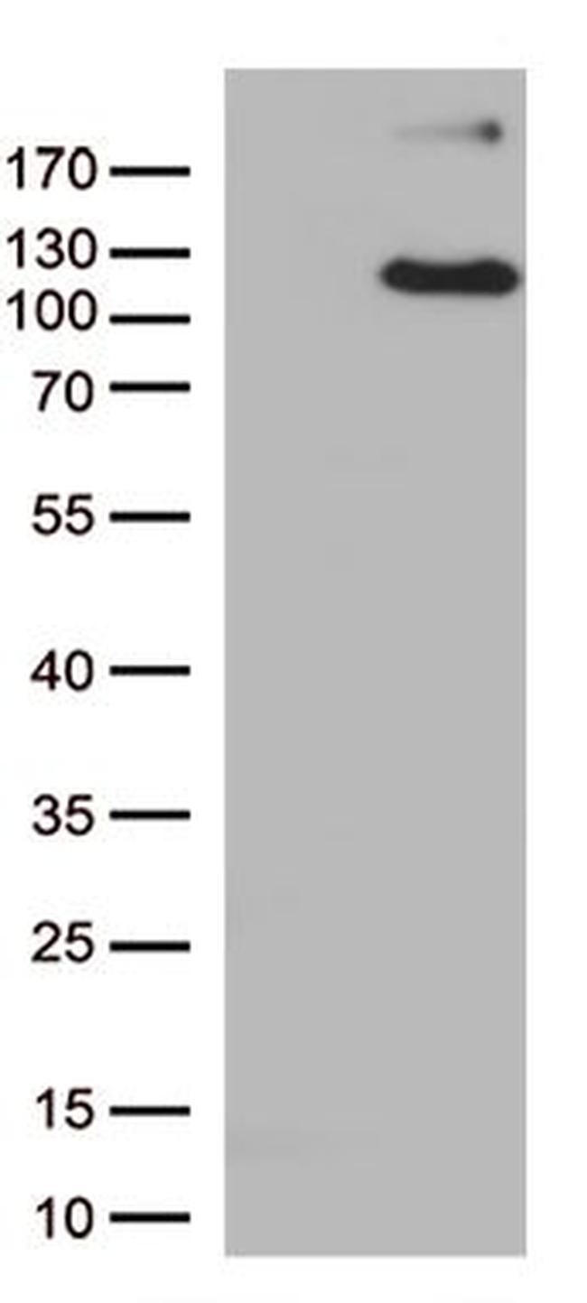ERAP1 Antibody in Western Blot (WB)