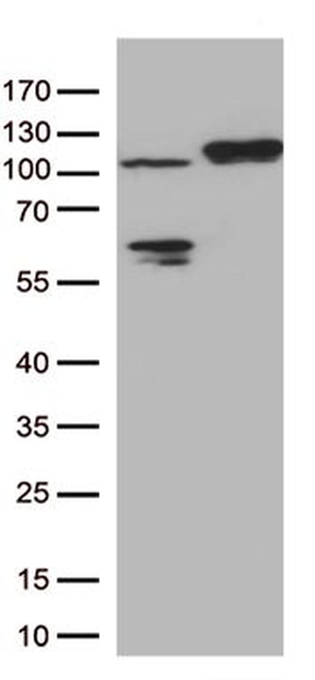 ERAP1 Antibody in Western Blot (WB)