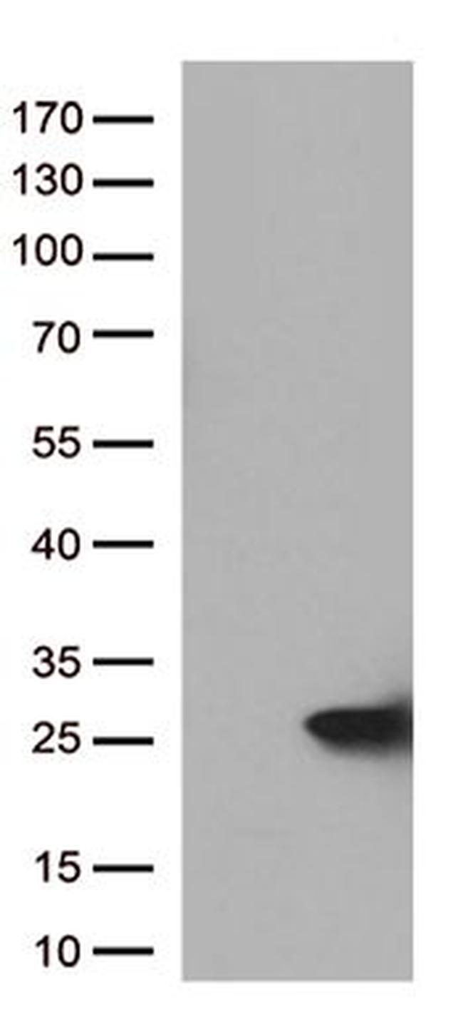 CYGB Antibody in Western Blot (WB)