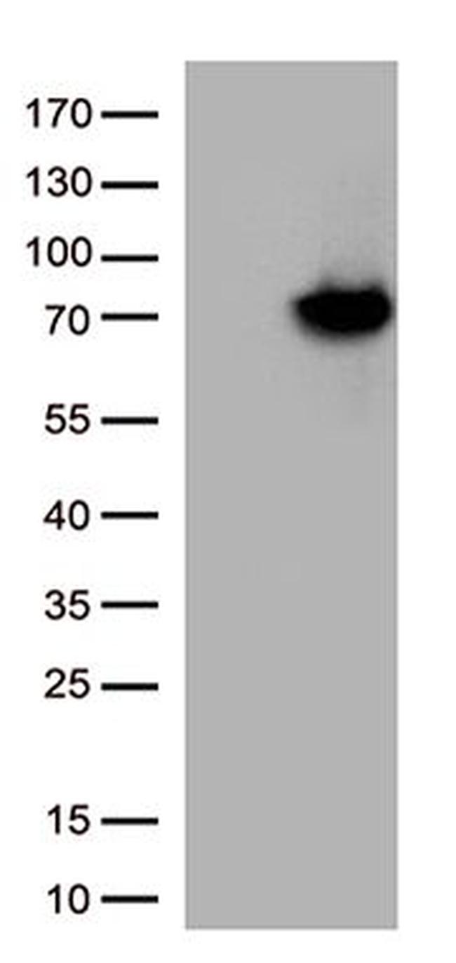 ARSB Antibody in Western Blot (WB)
