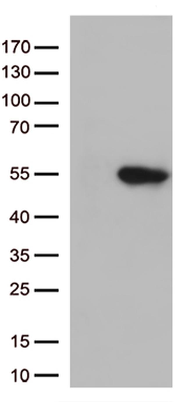 GNAL Antibody in Western Blot (WB)