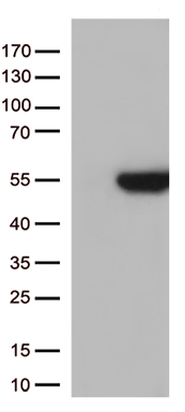 GNAL Antibody in Western Blot (WB)