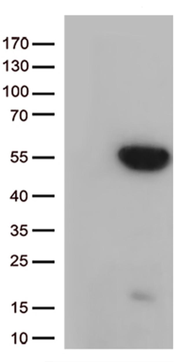 GNAL Antibody in Western Blot (WB)