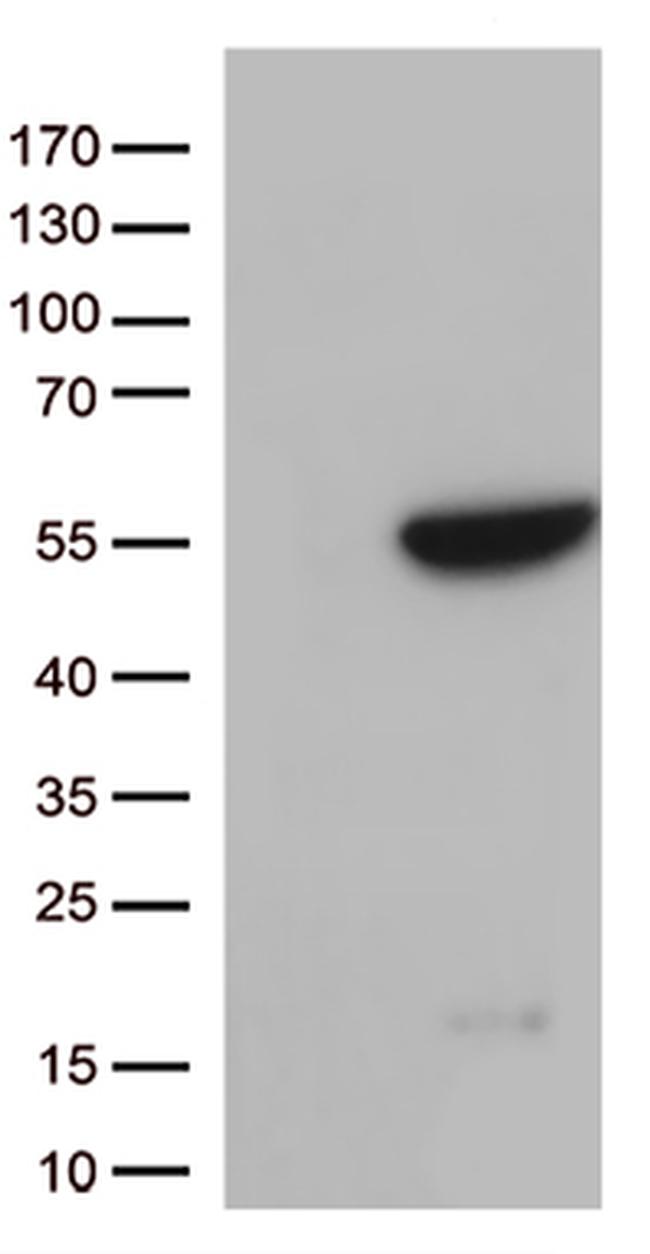 GNAL Antibody in Western Blot (WB)
