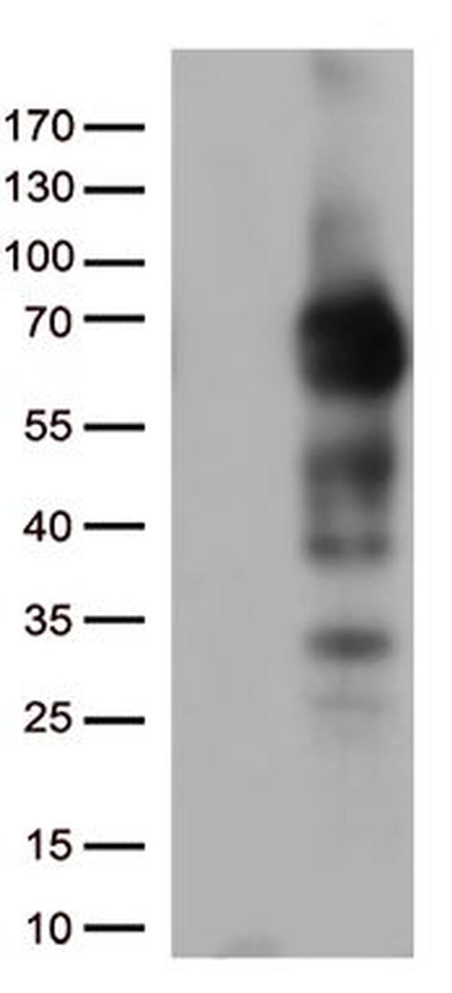 NGFR Antibody in Western Blot (WB)