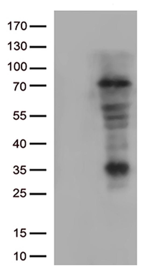 Lymphocyte Activation Gene 3 (LAG3) Antibody in Western Blot (WB)