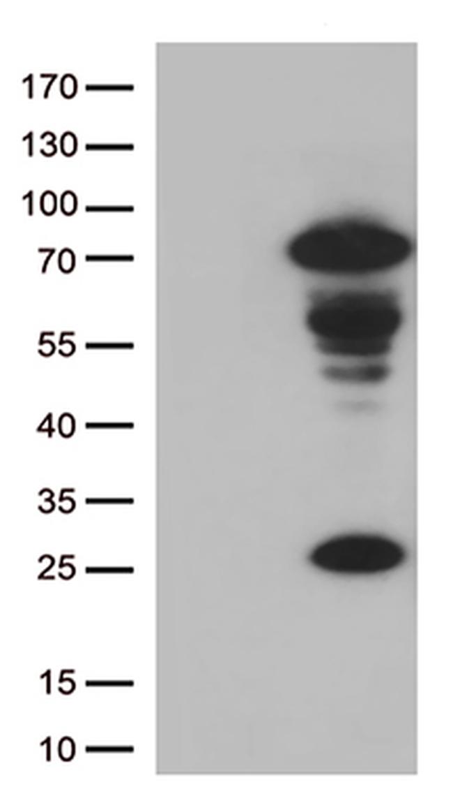 Lymphocyte Activation Gene 3 (LAG3) Antibody in Western Blot (WB)