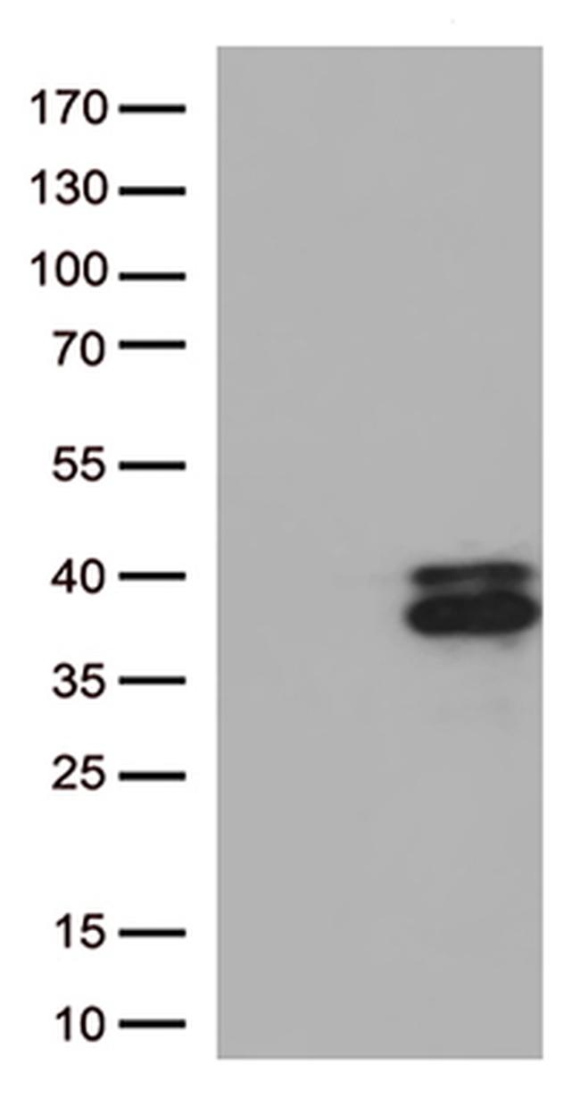 Major Basic Protein (PRG2) Antibody in Western Blot (WB)