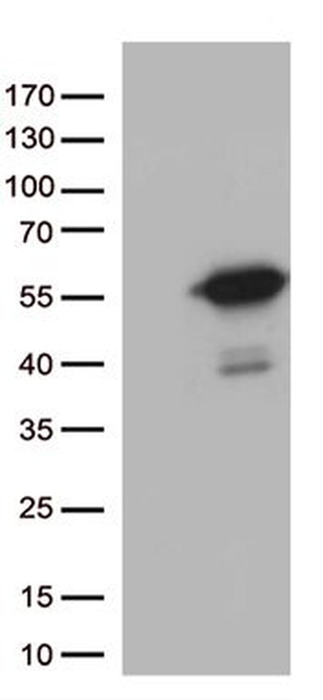 MTRF1 Antibody in Western Blot (WB)