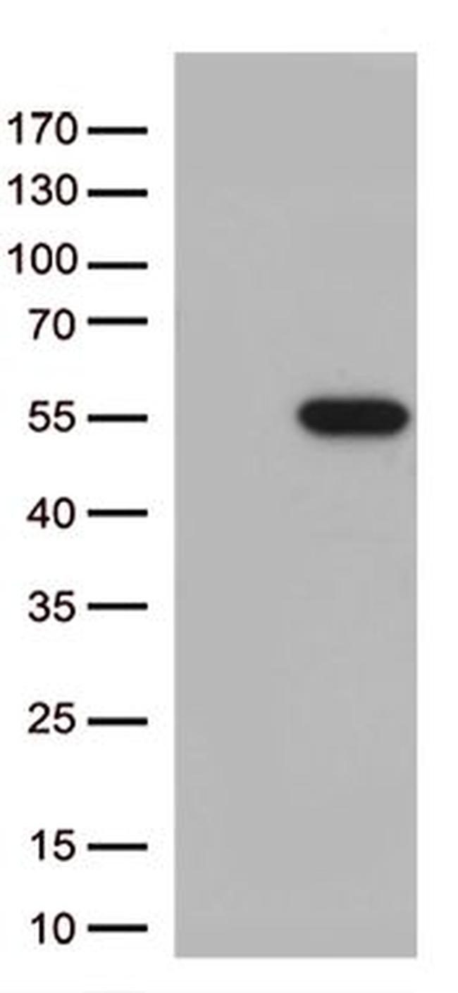 MTRF1 Antibody in Western Blot (WB)