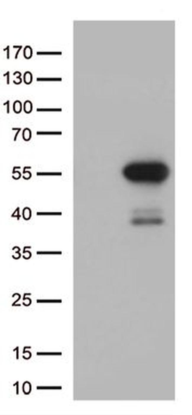 MTRF1 Antibody in Western Blot (WB)