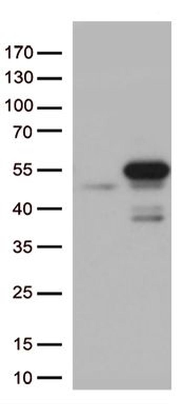 MTRF1 Antibody in Western Blot (WB)