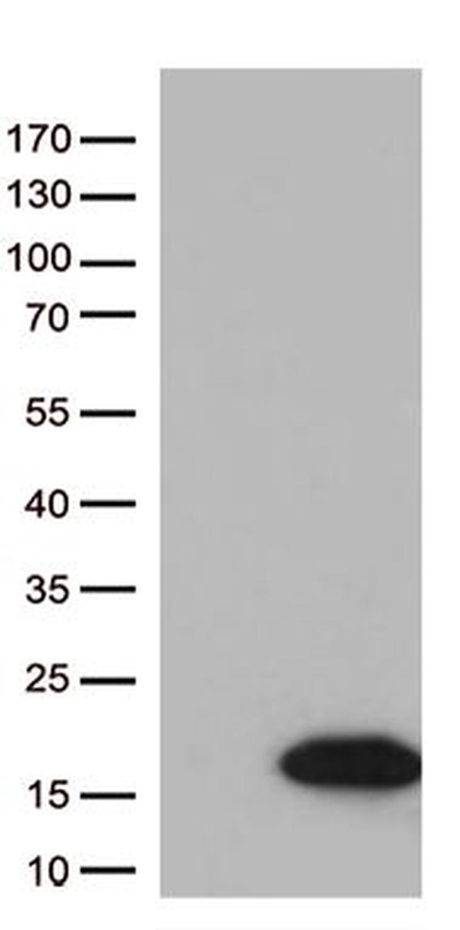 DBI Antibody in Western Blot (WB)