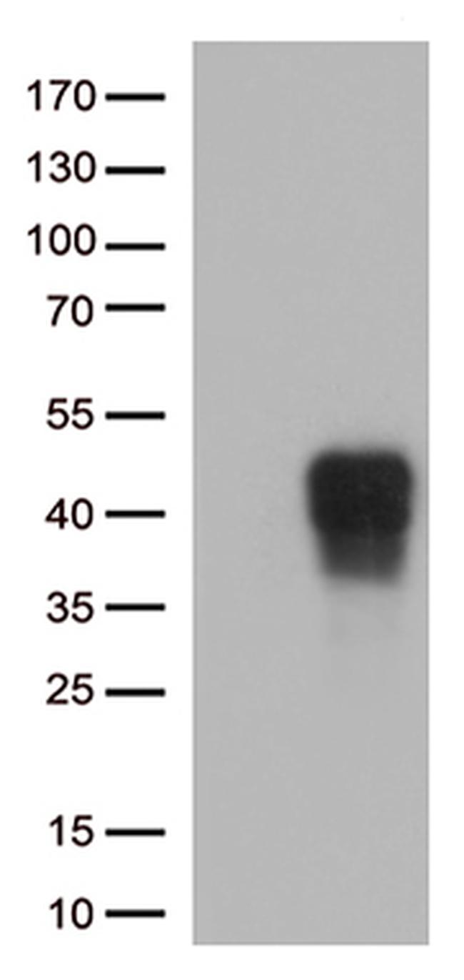 CD137 (TNFRSF9) Antibody in Western Blot (WB)