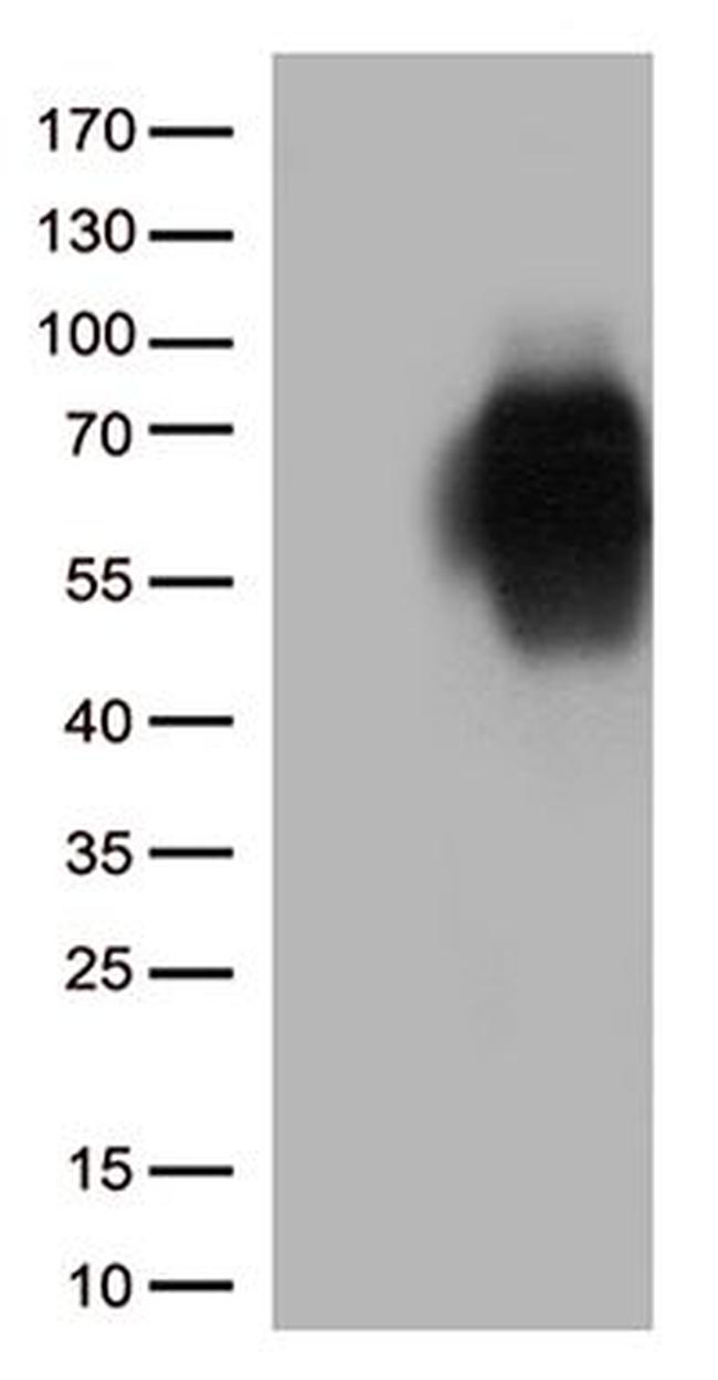 CD86 Antibody in Western Blot (WB)