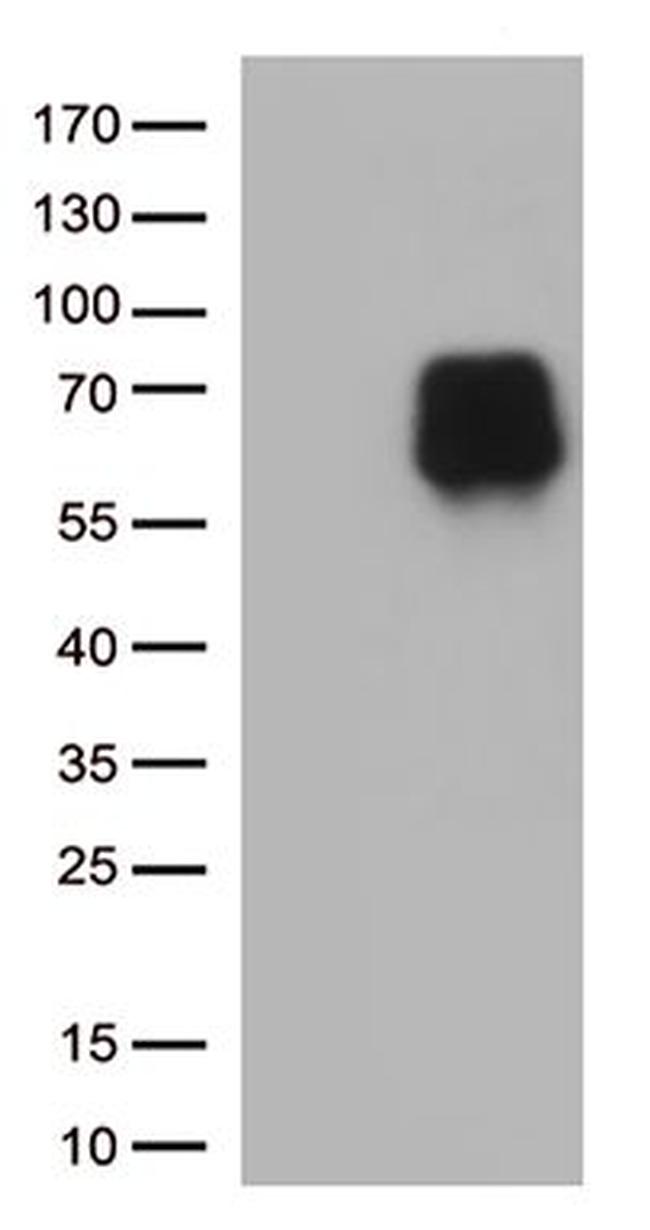 CD86 Antibody in Western Blot (WB)