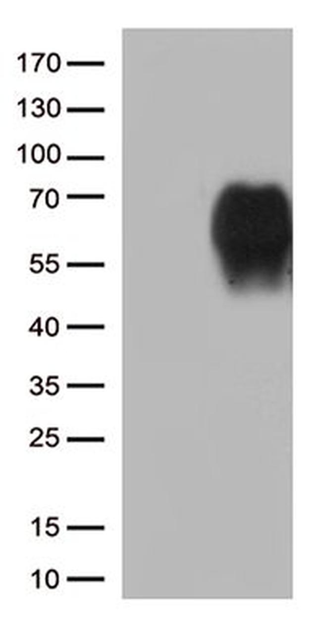 CD86 Antibody in Western Blot (WB)