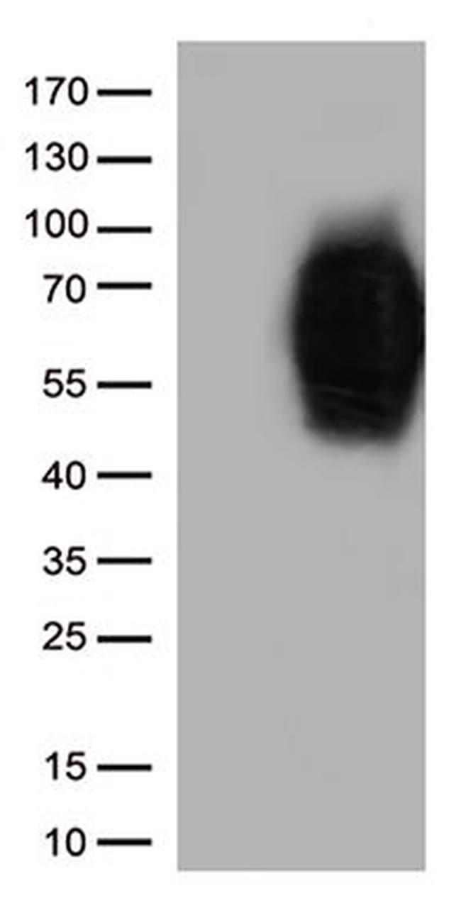 CD86 Antibody in Western Blot (WB)