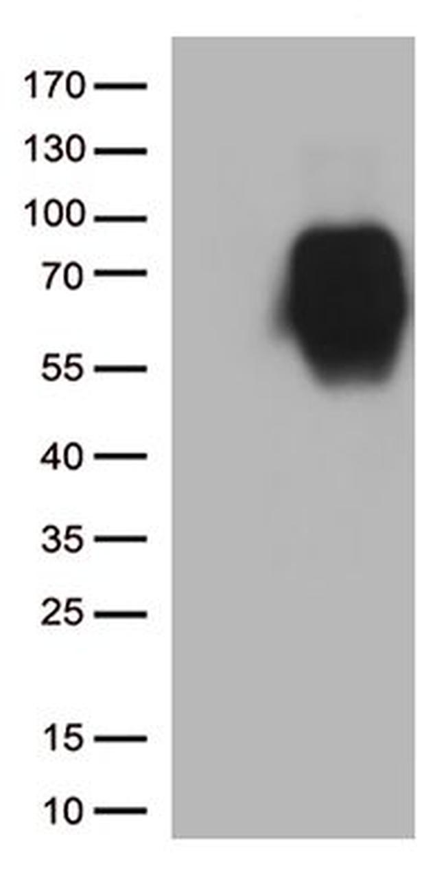 CD86 Antibody in Western Blot (WB)