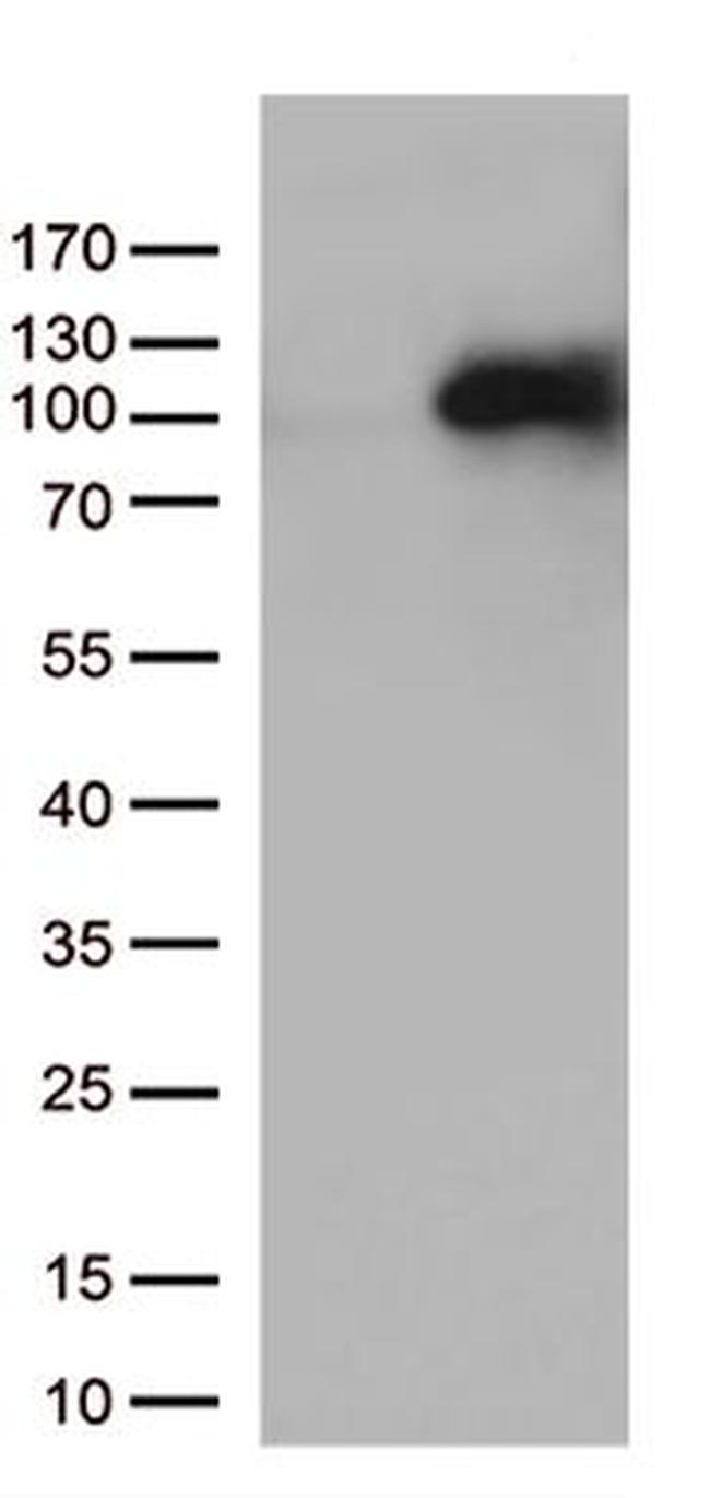 MEPCE Antibody in Western Blot (WB)