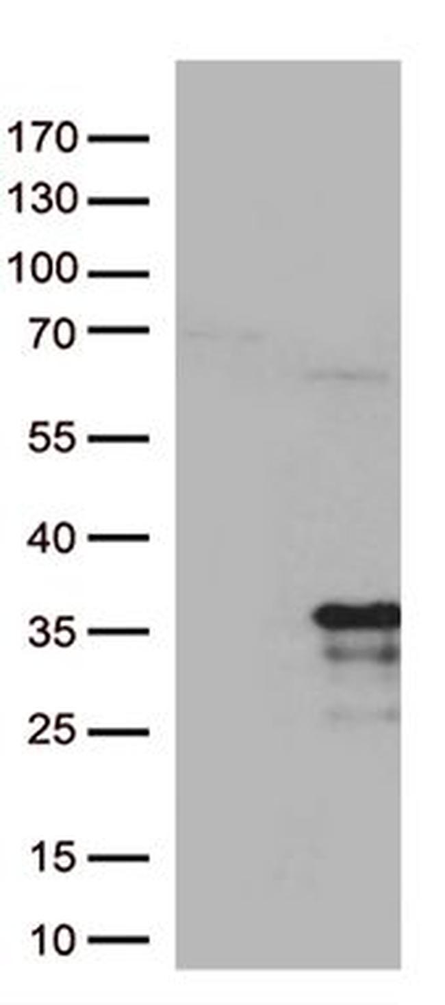 MRPL24 Antibody in Western Blot (WB)