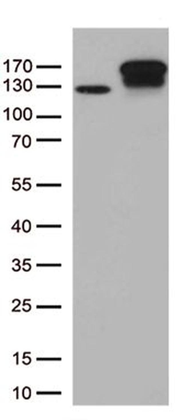 TRPS1 Antibody in Western Blot (WB)