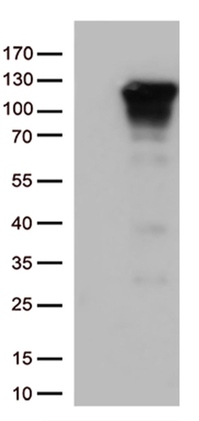 NFKB1 Antibody in Western Blot (WB)