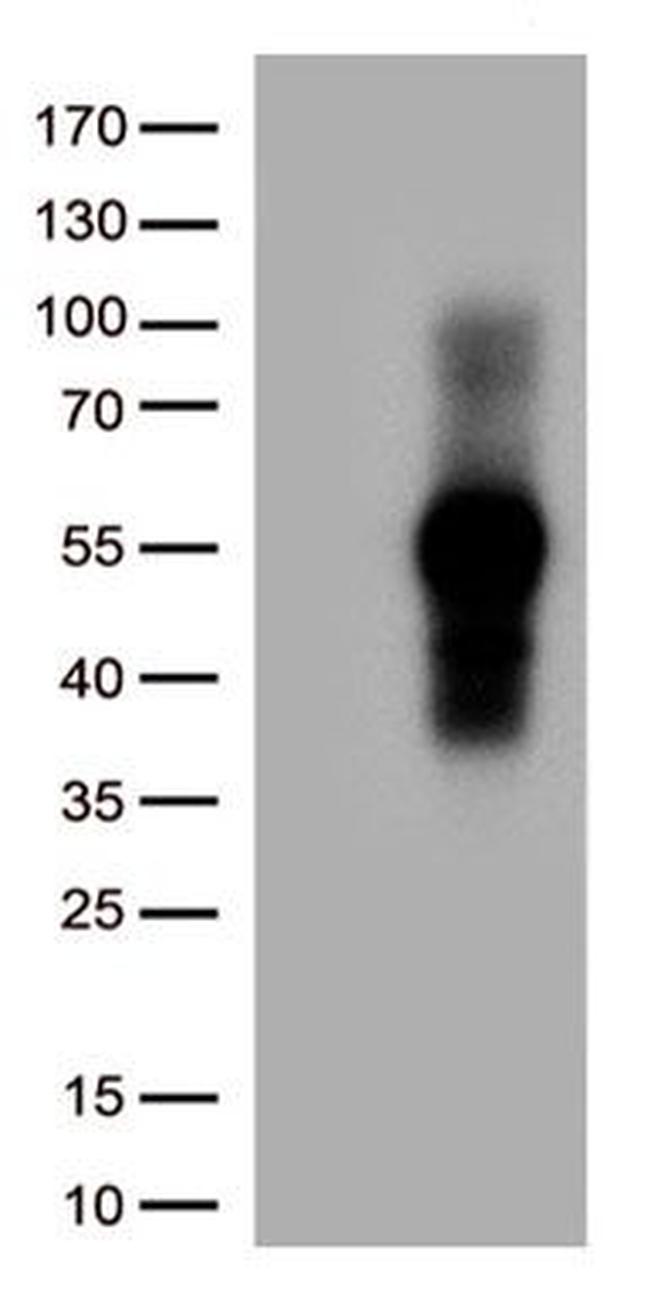 TNFRSF14 Antibody in Western Blot (WB)