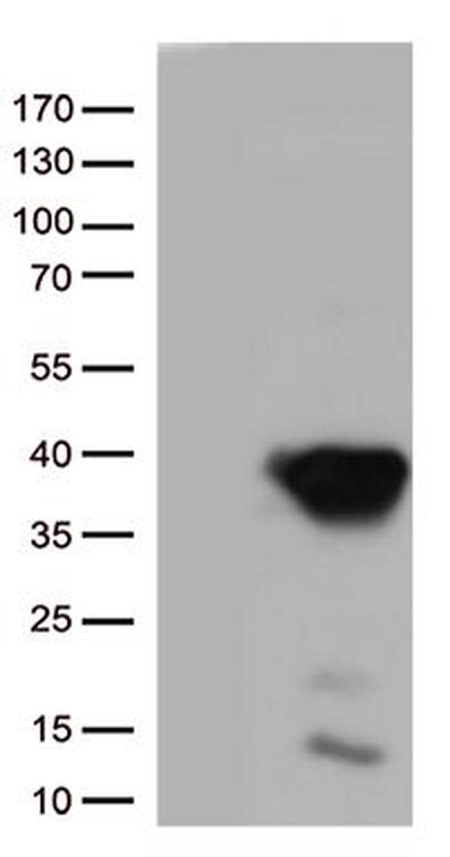 CASP3 Antibody in Western Blot (WB)