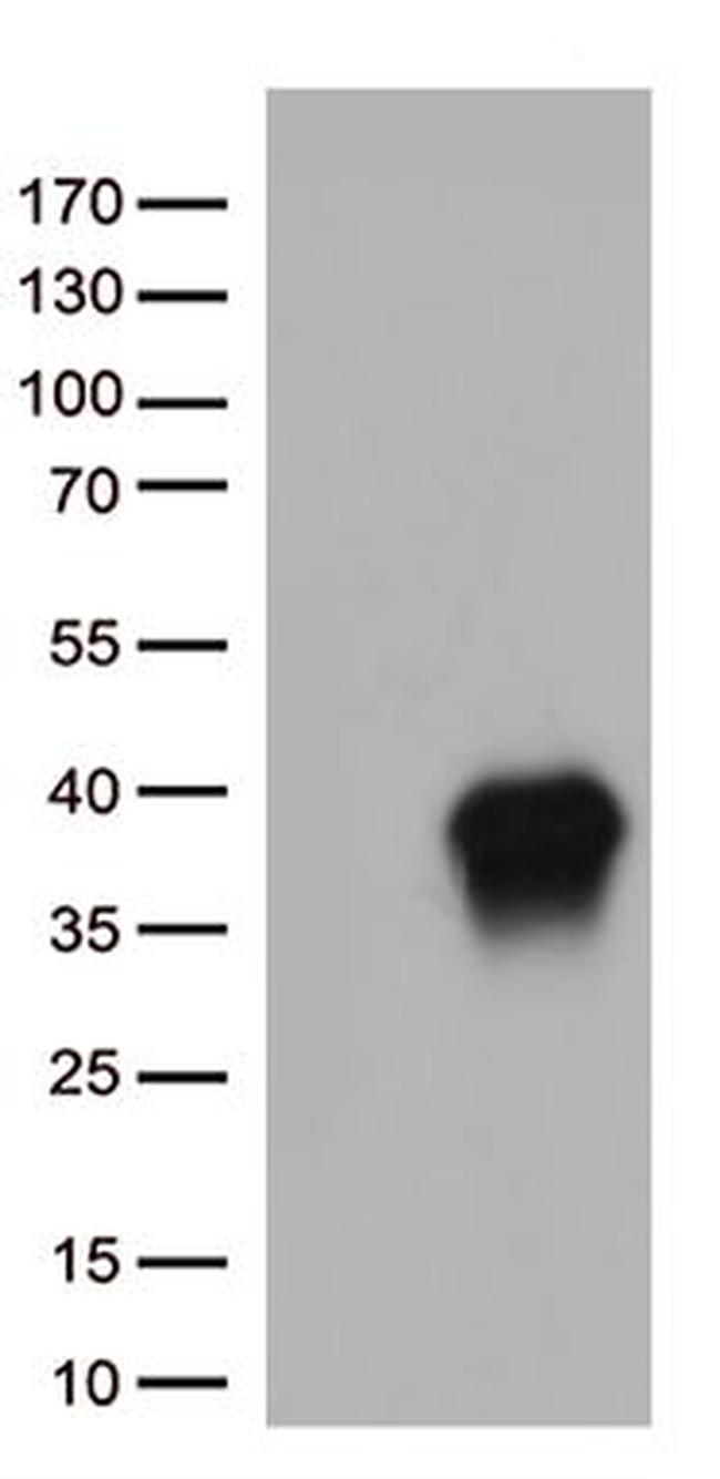 CASP3 Antibody in Western Blot (WB)