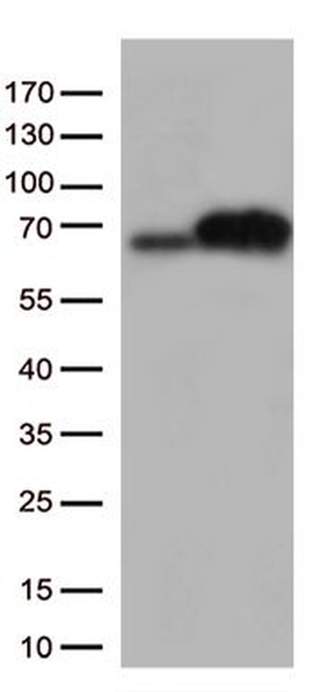 EIF2AK2 Antibody in Western Blot (WB)