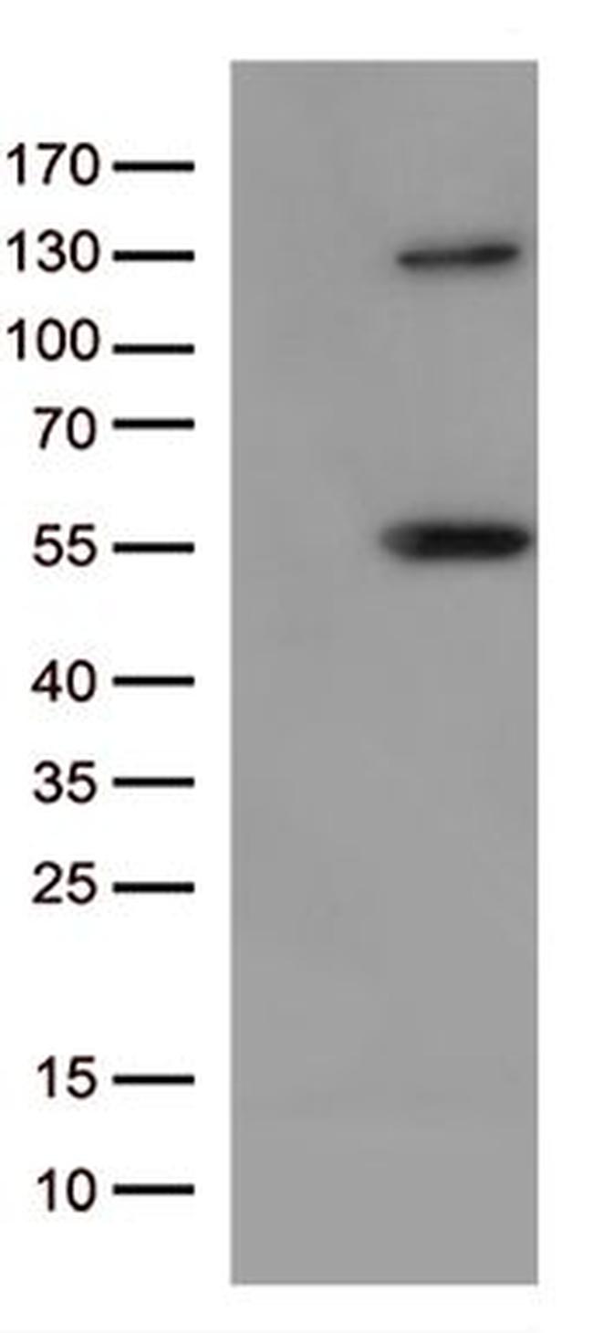 JNK1 Antibody in Western Blot (WB)