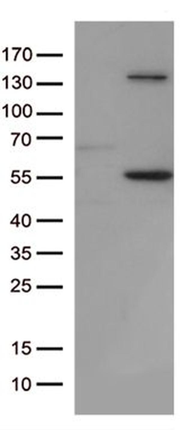 JNK1 Antibody in Western Blot (WB)