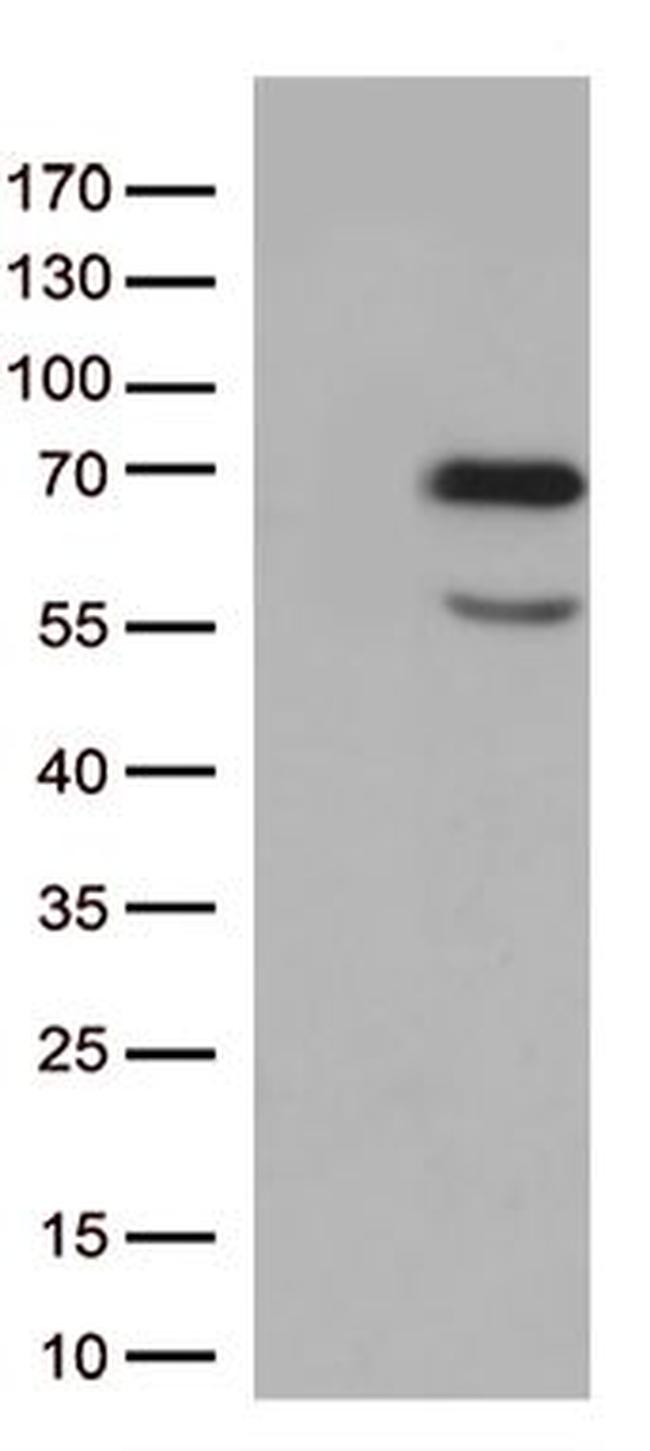 GNL3 Antibody in Western Blot (WB)