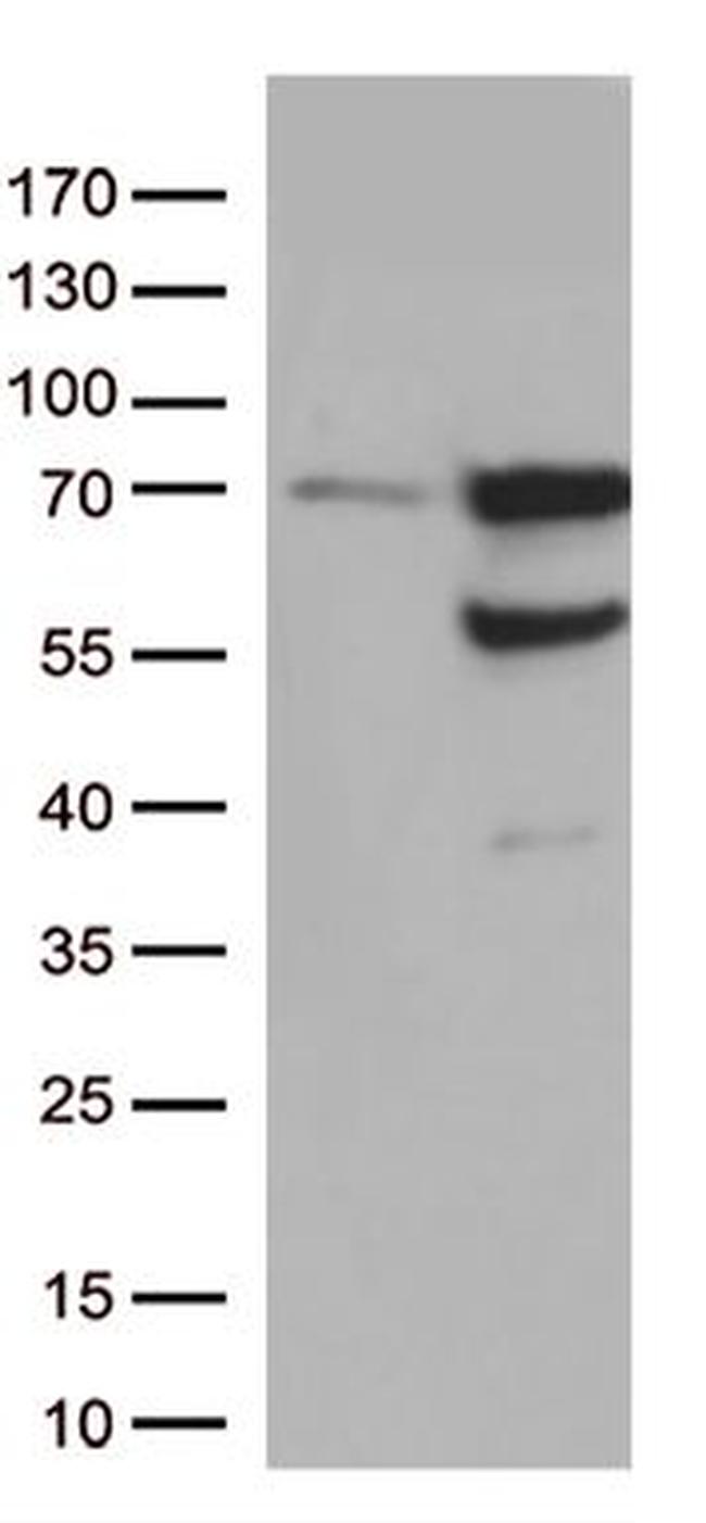 GNL3 Antibody in Western Blot (WB)