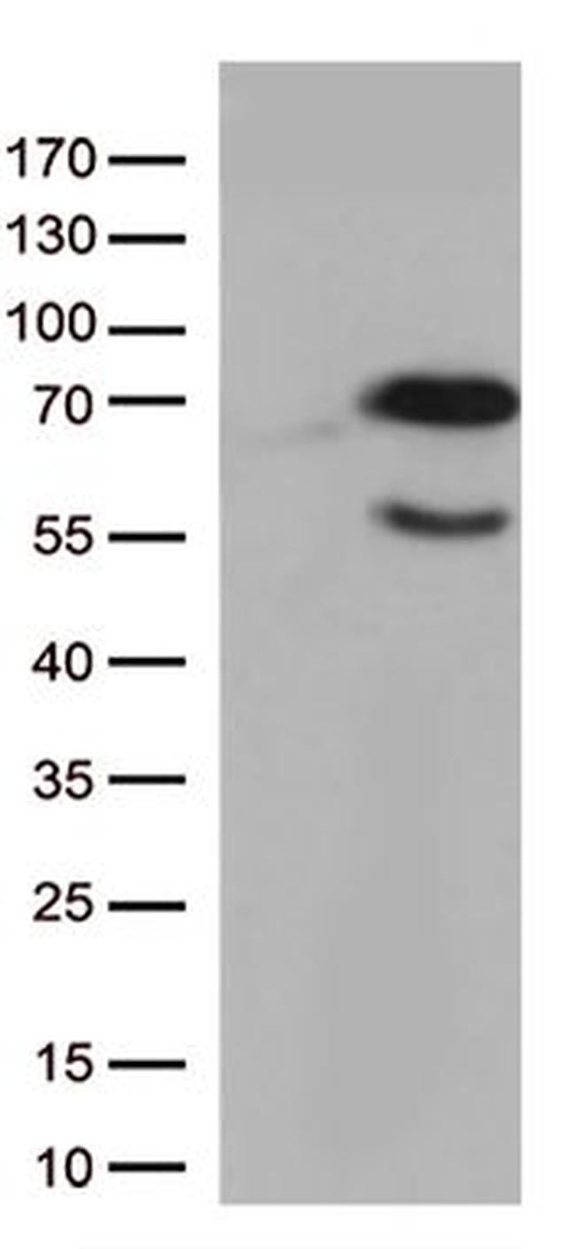 GNL3 Antibody in Western Blot (WB)