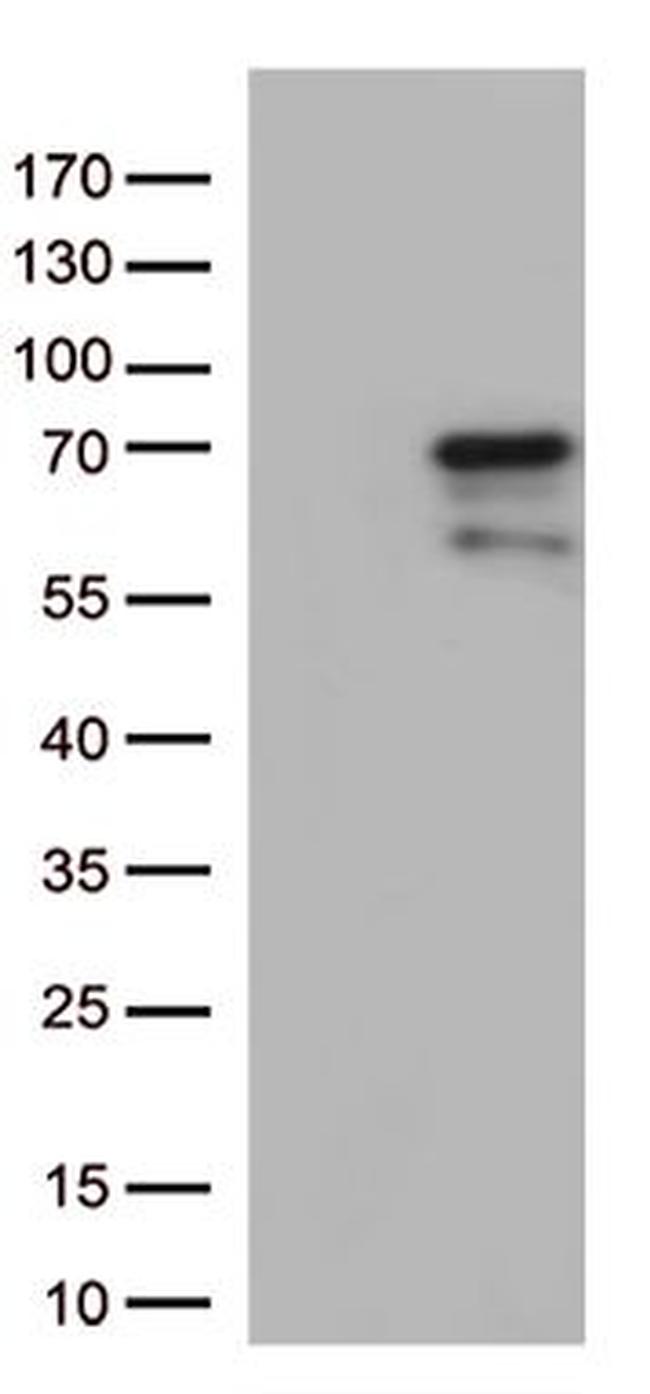 GNL3 Antibody in Western Blot (WB)