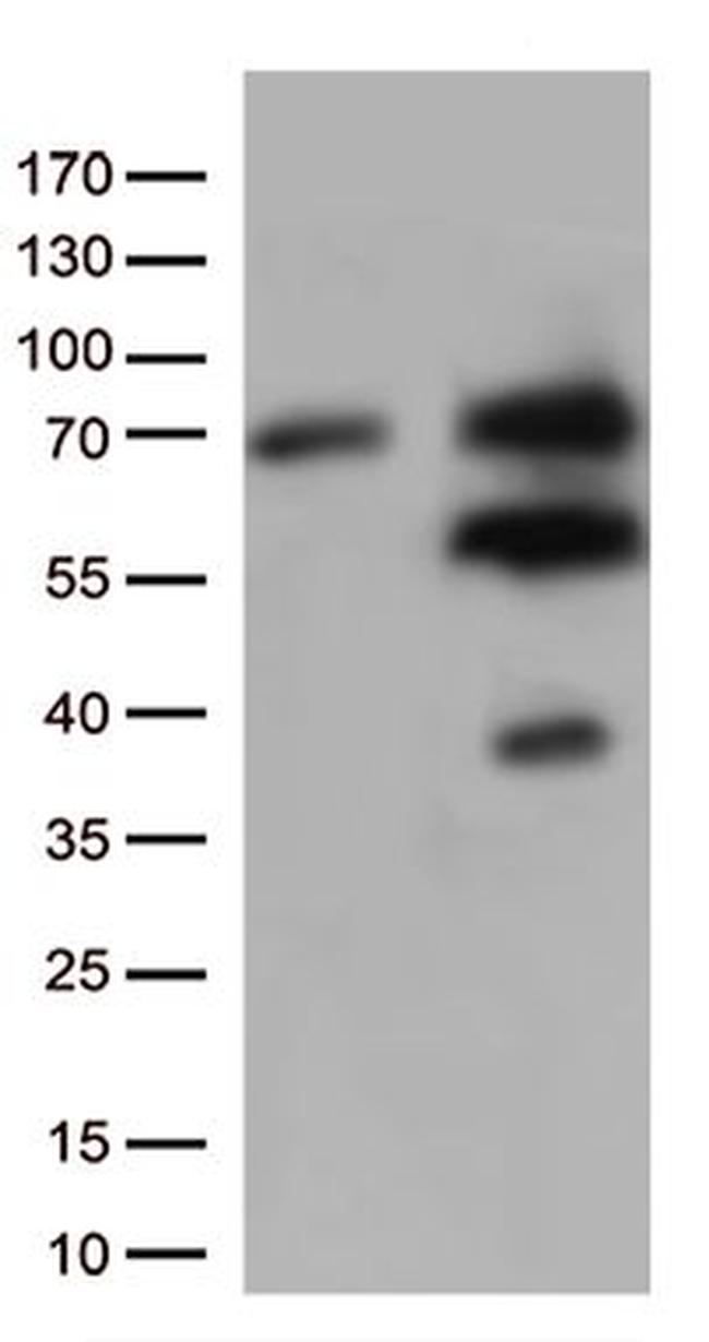 GNL3 Antibody in Western Blot (WB)