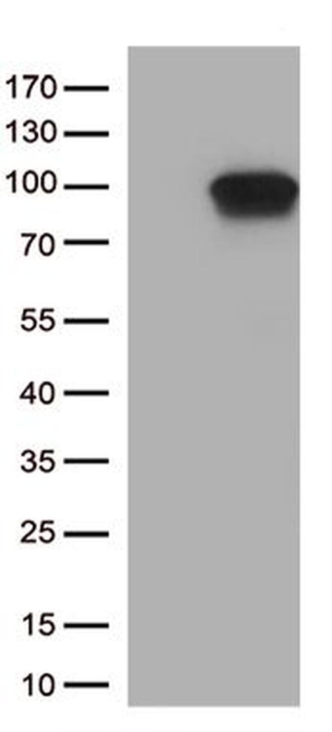 DDX4 Antibody in Western Blot (WB)
