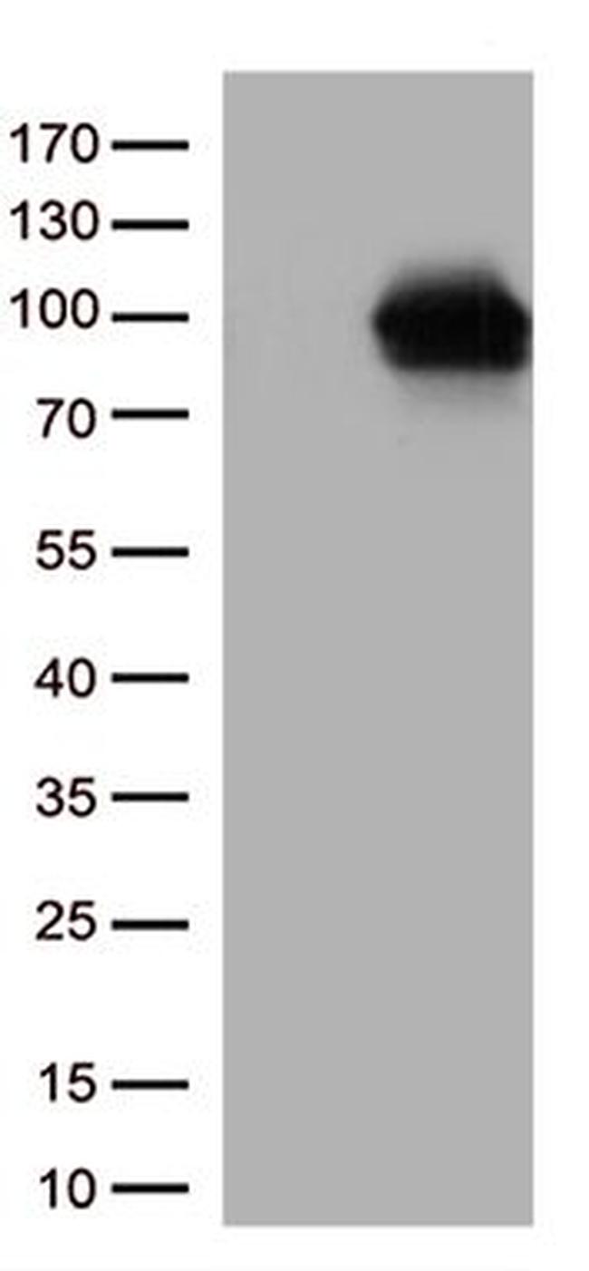 DDX4 Antibody in Western Blot (WB)