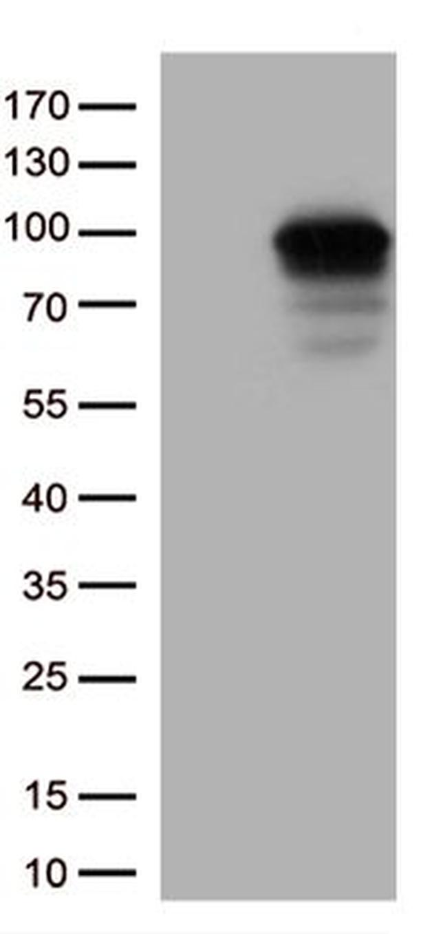 DDX4 Antibody in Western Blot (WB)